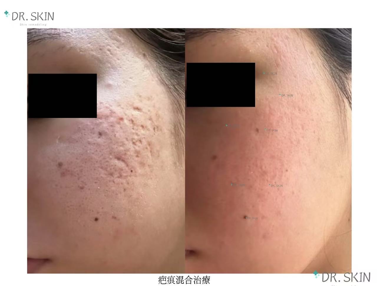 案例6